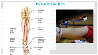 PRESENTACIÓN
• Los síntomas
• Dolor, incapacidad para soportar
peso
• Examen físico
• inspección y palpación
• Contusiones
• Ampollas
• Heridas abiertas
• Compartimientos
• Palpación
• El movimiento pasivo de los dedos del
pie
• Medición de la presión
intracompartimental si está indicado
• neurológica
• Peroneo profundo n.
• Peroneo superficial n.
• N sural.
• N tibial.
• N safena.
• PULSO
• Dorsal del pie
• Tibial posterior
• Asegúrese de revisar lado
contralateral
 