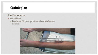 • fijación externa
• indicaciones
• Puede ser útil para proximal o fxs metafisarias
distales
Quirúrgico
 