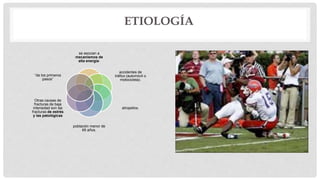 ETIOLOGÍA
se asocian a
mecanismos de
alta energía:
accidentes de
tráfico (automóvil o
motocicleta).
atropellos.
población menor de
65 años.
Otras causas de
fracturas de baja
intensidad son las
fracturas de estrés
y las patológicas
“de los primeros
pasos”
 
