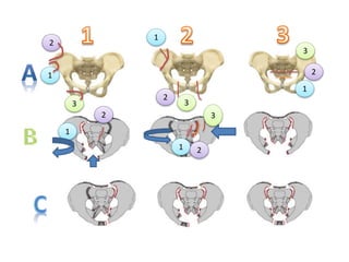 1
2
3
1
2
3
1
2
3
1
2
1 2
3
 