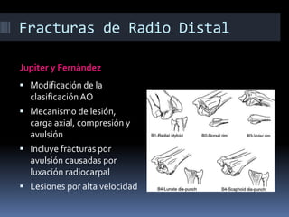 Fracturas de Radio DistalMayoSimilar a Frykman extensión de la fractura en superficie articularIntroduce extensión de la fractura en superficie radioescafoidea y radiosemilunarIgnora la apófisis estiloides del cubito