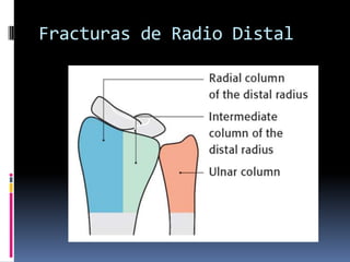 Fracturas de Radio DistalAO Type AEs la mas detalladaComprende 27 categoríasAbarca lesiones extraarticular, parcial articular, compleja articular.Type CType B 