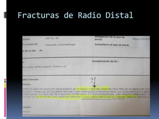 Fracturas de Radio DistalConclusión	La incorporación del impacto de la densidad mineral ósea sobre acortamiento, desplazamiento de la fractura facilitara la selección del tratamiento optimo con una consecuente ganancia sobre el pronostico de la lesión.Kettler, Do we need to include Osteoporosis in Todays Classification of Distal Radius Fractures? J Orthop Trauma. 22,8 Sep 2008