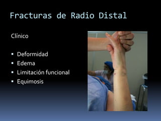 Fracturas de Radio DistalDiagnosticoClínicoImagenologico