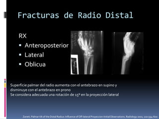 Fracturas de Radio DistalClínicoDeformidadEdemaLimitación funcionalEquimosis