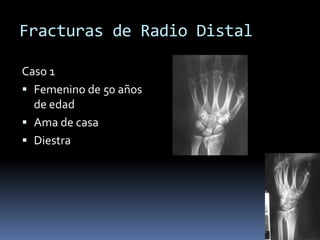 Fracturas de Radio DistalInjerto óseoSustituye el defecto óseoMejora la estabilidad de la fractura