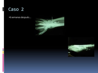 Caso 2Masculino 58 años de edad