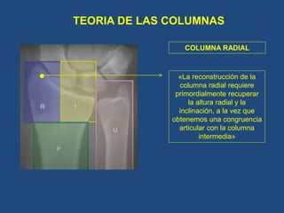 FRACTURAS DE RADIO DISTAL PÁEZ.pptx