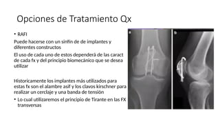 Asif Rafi FRACTURAS DE ROTULA O PATELA EXTREMIDAD INFERIOR.pptx