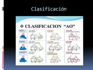 Clasificación
 
