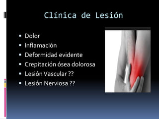 Clínica de Lesión
 Dolor
 Inflamación
 Deformidad evidente
 Crepitación ósea dolorosa
 LesiónVascular ??
 Lesión Nerviosa ??
 