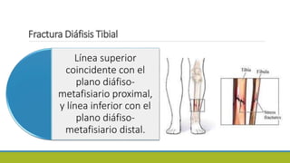 Fractura Diáfisis Tibial
Línea superior
coincidente con el
plano diáfiso-
metafisiario proximal,
y línea inferior con el
plano diáfiso-
metafisiario distal.
 
