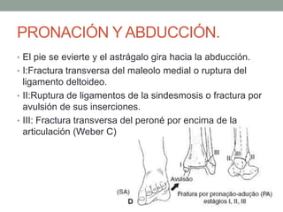 PRONACIÓN Y ABDUCCIÓN.
• El pie se evierte y el astrágalo gira hacia la abducción.
• I:Fractura transversa del maleolo medial o ruptura del
ligamento deltoideo.
• II:Ruptura de ligamentos de la sindesmosis o fractura por
avulsión de sus inserciones.
• III: Fractura transversa del peroné por encima de la
articulación (Weber C)
 