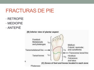 FRACTURAS DE PIE
• RETROPÍE
• MEDIOPIE
• ANTEPIÉ
 