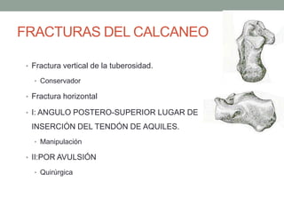 FRACTURAS DEL CALCANEO
• Fractura vertical de la tuberosidad.
• Conservador
• Fractura horizontal
• I: ANGULO POSTERO-SUPERIOR LUGAR DE
INSERCIÓN DEL TENDÓN DE AQUILES.
• Manipulación
• II:POR AVULSIÓN
• Quirúrgica
 