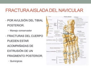 FRACTURAAISLADA DEL NAVICULAR
• POR AVULSIÓN DEL TIBIAL
POSTERIOR.
• Manejo conservador
• FRACTURAS DEL CUERPO
PUEDEN ESTAR
ACOMPAÑADAS DE
EXTRUSIÓN DE UN
FRAGMENTO POSTERIOR.
• Quirúrgicas
 