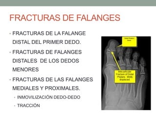 FRACTURAS DE FALANGES
• FRACTURAS DE LA FALANGE
DISTAL DEL PRIMER DEDO.
• FRACTURAS DE FALANGES
DISTALES DE LOS DEDOS
MENORES
• FRACTURAS DE LAS FALANGES
MEDIALES Y PROXIMALES.
• INMOVILIZACIÓN DEDO-DEDO
• TRACCIÓN
 