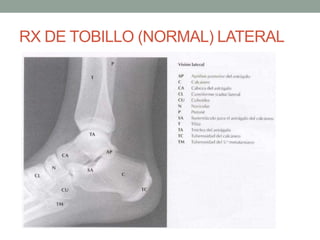 RX DE TOBILLO (NORMAL) LATERAL
 