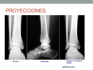 PROYECCIONES
(MORTAJA)
 
