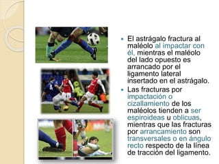  El astrágalo fractura al
maléolo al impactar con
él, mientras el maléolo
del lado opuesto es
arrancado por el
ligamento lateral
insertado en el astrágalo.
 Las fracturas por
impactación o
cizallamiento de los
maléolos tienden a ser
espiroideas u oblicuas,
mientras que las fracturas
por arrancamiento son
transversales o en ángulo
recto respecto de la línea
de tracción del ligamento.
 