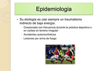 Epidemiologia
 Su etiología es casi siempre un traumatismo
indirecto de baja energía.
◦ Ocasionado con frecuencia durante la práctica deportiva o
en caídas en terreno irregular
◦ Accidentes automovilísticos
◦ Lesiones por arma de fuego
 