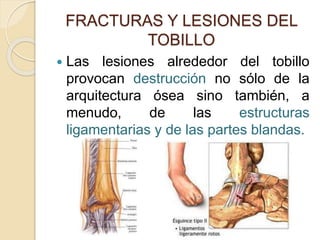 FRACTURAS Y LESIONES DEL
TOBILLO
 Las lesiones alrededor del tobillo
provocan destrucción no sólo de la
arquitectura ósea sino también, a
menudo, de las estructuras
ligamentarias y de las partes blandas.
 