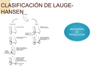 CLASIFICACIÓN DE LAUGE-
HANSEN
MECANISMO
DE
PRODUCCIÓN
 