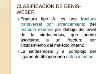 CLASIFICACION DE DENIS-
WEBER
 Fractura tipo A: es una fractura
transversal por arrancamiento del
maléolo externo por debajo del nivel
de la sindesmosis, que puede
asociarse a un fractura por
cizallamiento del maléolo interno.
 La sindesmosis y el complejo del
ligamento tibioperoneo están intactos.
 