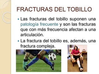 FRACTURAS DEL TOBILLO
 Las fracturas del tobillo suponen una
patología frecuente y son las fracturas
que con más frecuencia afectan a una
articulación.
 La fractura del tobillo es, además, una
fractura compleja.
 