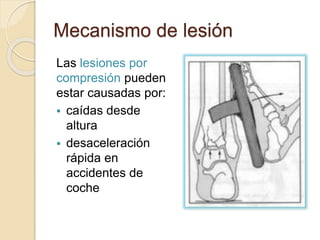 Mecanismo de lesión
Las lesiones por
compresión pueden
estar causadas por:
 caídas desde
altura
 desaceleración
rápida en
accidentes de
coche
 