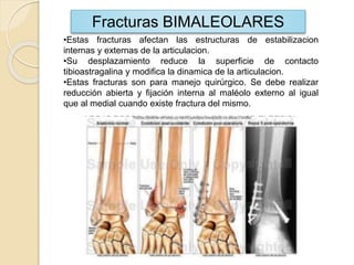 •Estas fracturas afectan las estructuras de estabilizacion
internas y externas de la articulacion.
•Su desplazamiento reduce la superficie de contacto
tibioastragalina y modifica la dinamica de la articulacion.
•Estas fracturas son para manejo quirúrgico. Se debe realizar
reducción abierta y fijación interna al maléolo externo al igual
que al medial cuando existe fractura del mismo.
Fracturas BIMALEOLARES
 