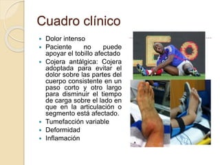 Cuadro clínico
 Dolor intenso
 Paciente no puede
apoyar el tobillo afectado
 Cojera antálgica: Cojera
adoptada para evitar el
dolor sobre las partes del
cuerpo consistente en un
paso corto y otro largo
para disminuir el tiempo
de carga sobre el lado en
que en la articulación o
segmento está afectado.
 Tumefacción variable
 Deformidad
 Inflamación
 