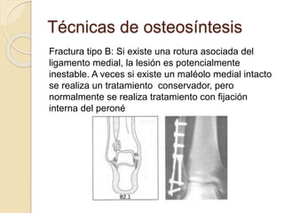 Técnicas de osteosíntesis
Fractura tipo B: Si existe una rotura asociada del
ligamento medial, la lesión es potencialmente
inestable. A veces si existe un maléolo medial intacto
se realiza un tratamiento conservador, pero
normalmente se realiza tratamiento con fijación
interna del peroné
 