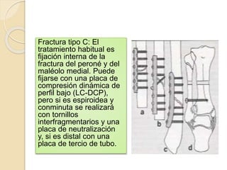Fractura tipo C: El
tratamiento habitual es
fijación interna de la
fractura del peroné y del
maléolo medial. Puede
fijarse con una placa de
compresión dinámica de
perfil bajo (LC-DCP),
pero si es espiroidea y
conminuta se realizará
con tornillos
interfragmentarios y una
placa de neutralización
y, si es distal con una
placa de tercio de tubo.
 