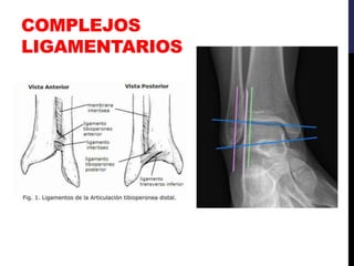 COMPLEJOS
LIGAMENTARIOS
 