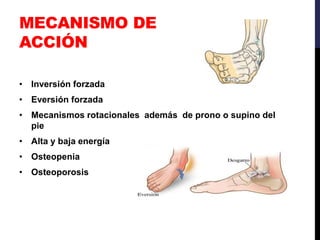 MECANISMO DE
ACCIÓN
• Inversión forzada
• Eversión forzada
• Mecanismos rotacionales además de prono o supino del
pie
• Alta y baja energía
• Osteopenia
• Osteoporosis