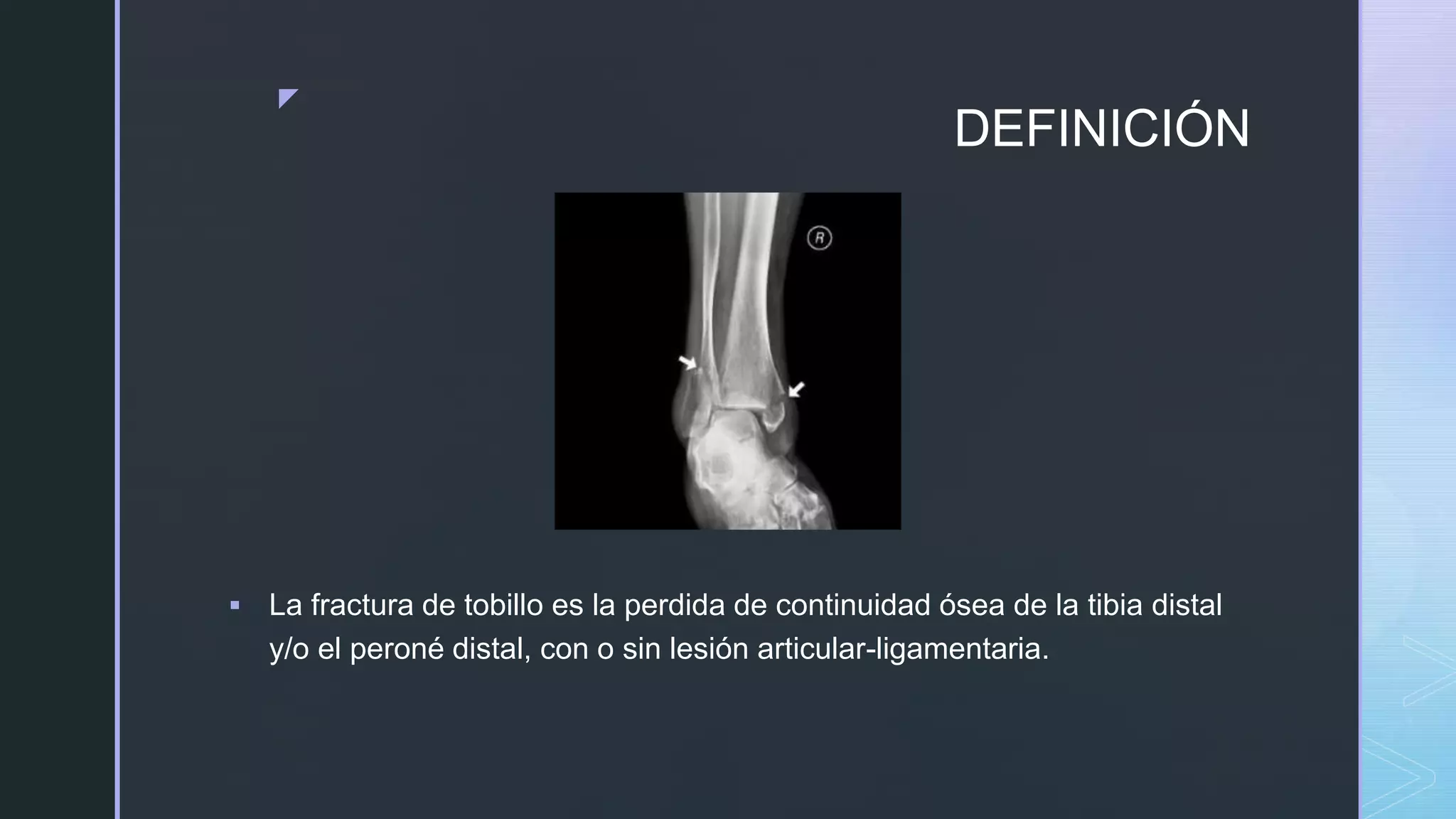 FRACTURAS DE TOBILLO.pptx