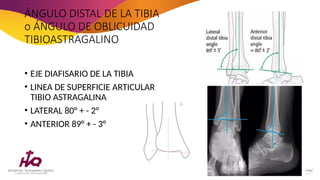Tibia Linea FRACTURAS DE Tobillo y sus clasificación | PPTX