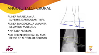 Angulo Tobillo FRACTURAS DE Tobillo y sus clasificación | PPTX