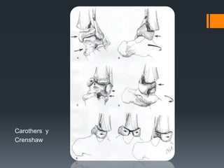 Carothers y
Crenshaw
 