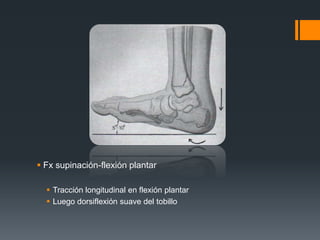  Fx supinación-flexión plantar
 Tracción longitudinal en flexión plantar
 Luego dorsiflexión suave del tobillo
 