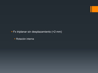  Fx triplanar sin desplazamiento (<2 mm)
 Rotación interna
 