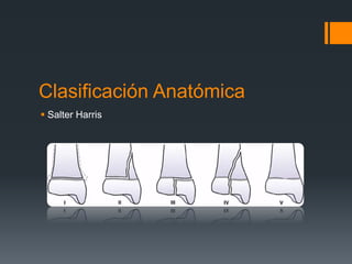 Clasificación Anatómica
 Salter Harris
 
