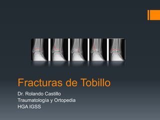 Fracturas de Tobillo
Dr. Rolando Castillo
Traumatología y Ortopedia
HGA IGSS
 