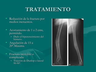 TTRRAATTAAMMIIEENNTTOO 
• RReedduucccciióónn ddee llaa ffrraaccttuurraa ppoorr 
mmeeddiiooss iinnccrruueennttooss.. 
• AAccoorrttaammiieennttoo ddee 11 aa 22 ccmmss,, 
ppeerrmmiittiiddoo.. 
– DDaaddoo eell hhiippeerrccrreecciimmiieennttoo ddeell 
hhúúmmeerroo.. 
• AAnngguullaacciióónn ddee 1155 aa 
2200º..MMááxxiimmaa.. 
• FFrraaccttuurraa iinneessttaabbllee oo 
ccoommpplliiccaaddaa:: 
– TTrraacccciióónn ddee DDuunnlloopp oo llaatteerraall 
9900--9900º.. 
 