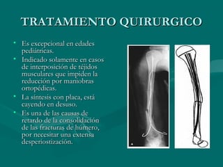 TTRRAATTAAMMIIEENNTTOO QQUUIIRRUURRGGIICCOO 
• EEss eexxcceeppcciioonnaall eenn eeddaaddeess 
ppeeddiiááttrriiccaass.. 
• IInnddiiccaaddoo ssoollaammeennttee eenn ccaassooss 
ddee iinntteerrppoossiicciióónn ddee ttééjjiiddooss 
mmuussccuullaarreess qquuee iimmppiiddeenn llaa 
rreedduucccciióónn ppoorr mmaanniioobbrraass 
oorrttooppééddiiccaass.. 
• LLaa ssíínntteessiiss ccoonn ppllaaccaa,, eessttáá 
ccaayyeennddoo eenn ddeessuussoo.. 
• EEss uunnaa ddee llaass ccaauussaass ddee 
rreettaarrddoo ddee llaa ccoonnssoolliiddaacciióónn 
ddee llaass ffrraaccttuurraass ddee hhúúmmeerroo,, 
ppoorr nneecceessiittaarr uunnaa eexxtteennssaa 
ddeessppeerriioossttiizzaacciióónn.. 
 