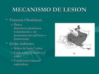 MMEECCAANNIISSMMOO DDEE LLEESSIIOONN 
• FFrraaccttuurraass OObbssttééttrriiccaass:: 
– PPaarrttooss 
ddiissttóócciiccooss(( pprroodduuccttooss 
vvoolluummiinnoossooss yy eenn 
pprreesseennttaacciioonneess ppééllvviiccaass oo 
ttrraannssvveerrssaass)).. 
• GGoollppee iinnddiirreeccttoo:: 
– NNiiññooss ddee hhaassttaa 33 aaññooss.. 
– CCaaííddaa ssoobbrree llaa mmaannoo oo eell 
ccooddoo.. 
– CCoonnddiicciioonnaa ffrraaccttuurraass 
eessppiirrooiiddeeaass.. 
 