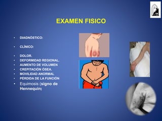 EXAMEN FISICO
• DIAGNÓSTICO:
• CLÍNICO:
• DOLOR.
• DEFORMIDAD REGIONAL.
• AUMENTO DE VOLUMEN
• CREPITACIÓN ÓSEA.
• MOVILIDAD ANORMAL
• PÉRDIDA DE LA FUNCIÓN
• Equimosis (signo de
Hennequin)
 