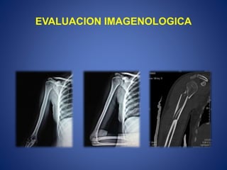 EVALUACION IMAGENOLOGICA
 