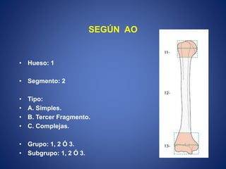 SEGÚN AO
• Hueso: 1
• Segmento: 2
• Tipo:
• A. Simples.
• B. Tercer Fragmento.
• C. Complejas.
• Grupo: 1, 2 Ó 3.
• Subgrupo: 1, 2 Ó 3.
 
